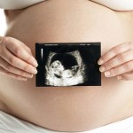 Obstetrical / Pregnancy Ultrasound